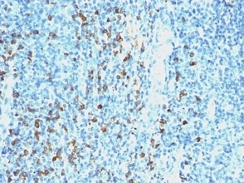 IGLV1-51, cycH Antibody