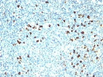 IGKC Antibody