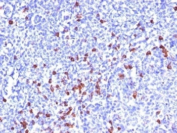 IGHG1, IGHG2, IGHG3, IGHG4 Antibody