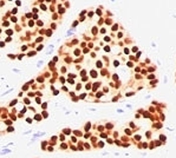 ESR1 Antibody