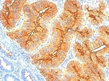 TAG-72 Antibody [SPM148]