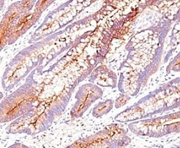 CEA Antibody [SPM584]