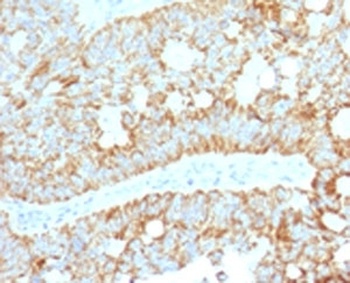 MAML2 Antibody [MMLP2-1]