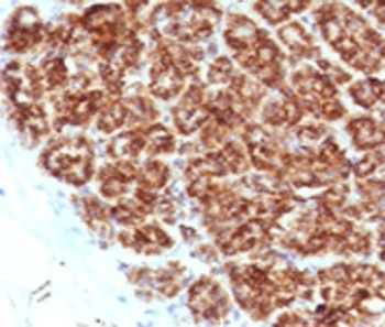 MAML2 Antibody [MMLP2-1]