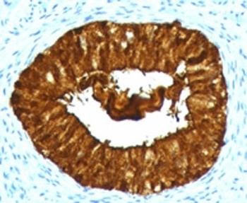 MAML3 Antibody