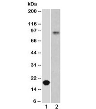 E-Cadherin Antibody [ECD1-2]