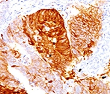 ALDH1A1 Antibody