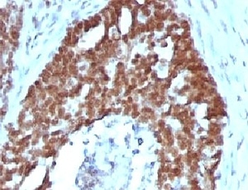 Nucleolin Antibody [NPC23-2]