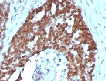 NCL Antibody