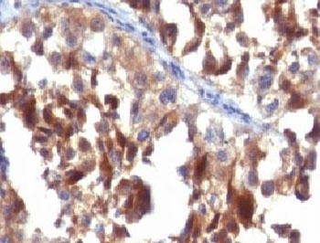 CD63 Antibody