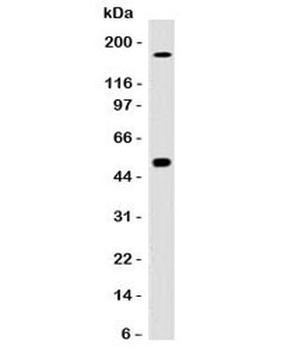 CA9 Antibody