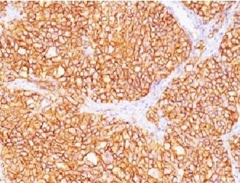 CA9 Antibody