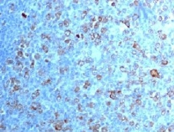 CDK1 Antibody
