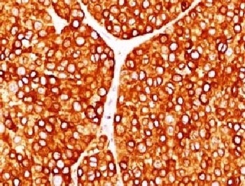 TYR Antibody