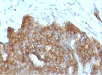 TFF1 Antibody