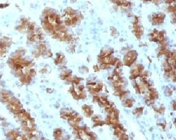 TNF Antibody