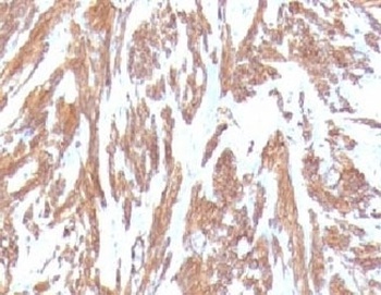 ACTA2 Antibody