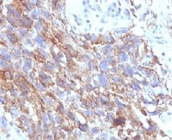 NCAM1 Antibody