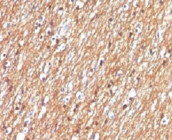 NCAM1 Antibody