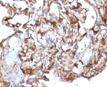 MCAM Antibody