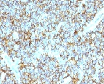 CD99 Antibody [CDLA99]