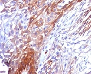 KRT17 Antibody