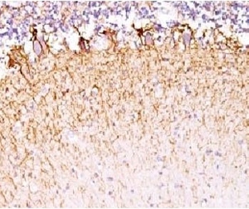 NEFL Antibody