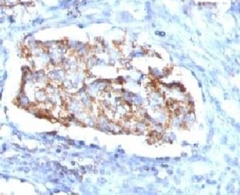 HSP60 Antibody [SRPR60]
