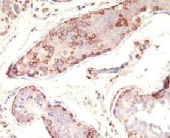 MAGEA1 Antibody