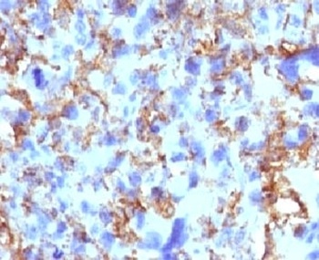 HLA-DRB1 Antibody