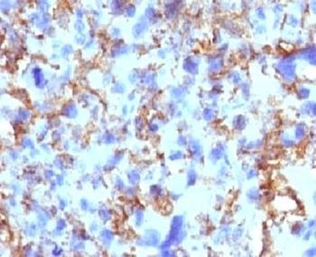 HLA-DRB1 Antibody [MHDRb2]