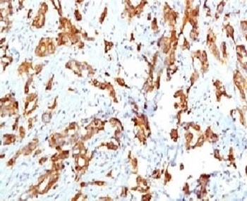 HSP27 Antibody [SRPR27]