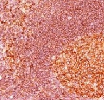MALT1 Antibody