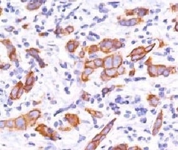Her2 Antibody