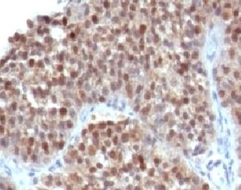 CDKN1A Antibody
