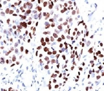 CDKN1A Antibody
