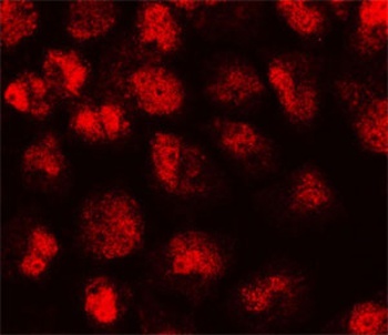 CDKN1A Antibody