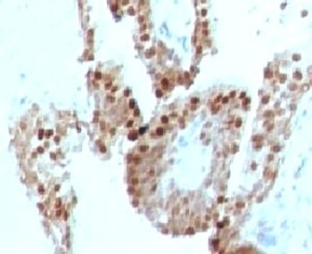 CDKN1C Antibody