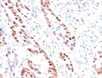 CDKN1C Antibody