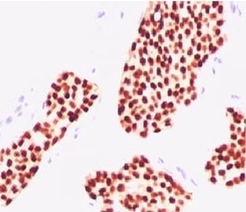 ESR1 Antibody