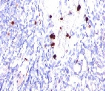 CSF3 Antibody