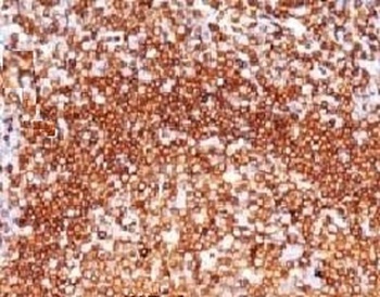 CD79A Antibody