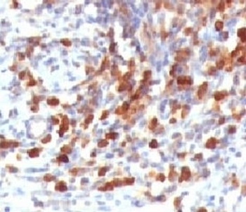 CD79A Antibody