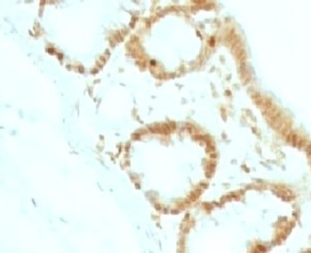 CDKN1B Antibody