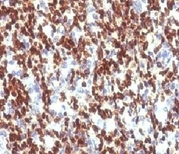 PAX7 Antibody