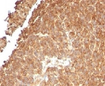 TOP1MT Antibody