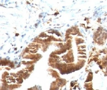 TOP1MT Antibody