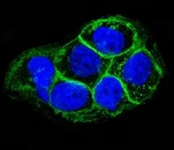 EGFR Antibody [ERB59-1]
