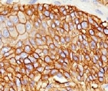 EGFR Antibody [ERB59-1]