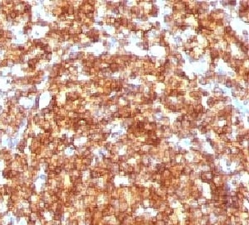 PTPRC Antibody